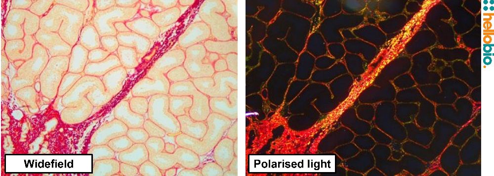 Figure. 13: Picro Sirius red staining in Bouins fixed Chimpanzee testis under both standard widefield illumination and polarised light. 