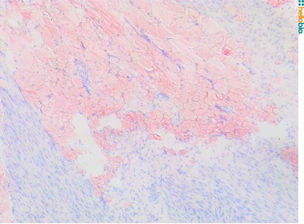 Modified Mayer's Hematoxylin  (HB6189) nuclear staining in mesenteric connective tissue.