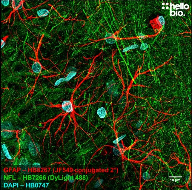 Fig 2. GFAP expression in rat brain visualised using a Janelia Fluor® 549 conjugated secondary antibody. 