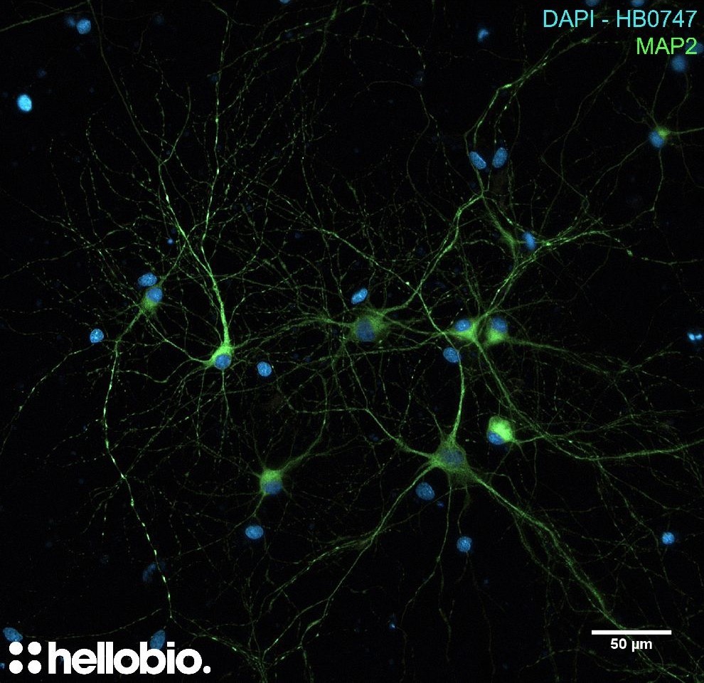 Figure 3. MAP2 and DAPI co-staining in hippocampal cell culture