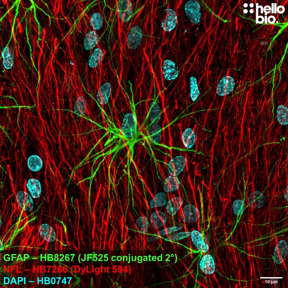 Fig 1. GFAP expression in rat brain visualised using a Janelia Fluor® 525 conjugated secondary antibody. 