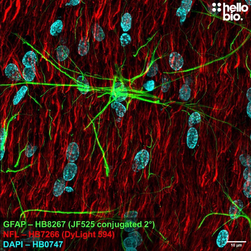 Fig 2. GFAP expression in rat brain visualised using a Janelia Fluor® 525 conjugated secondary antibody. 