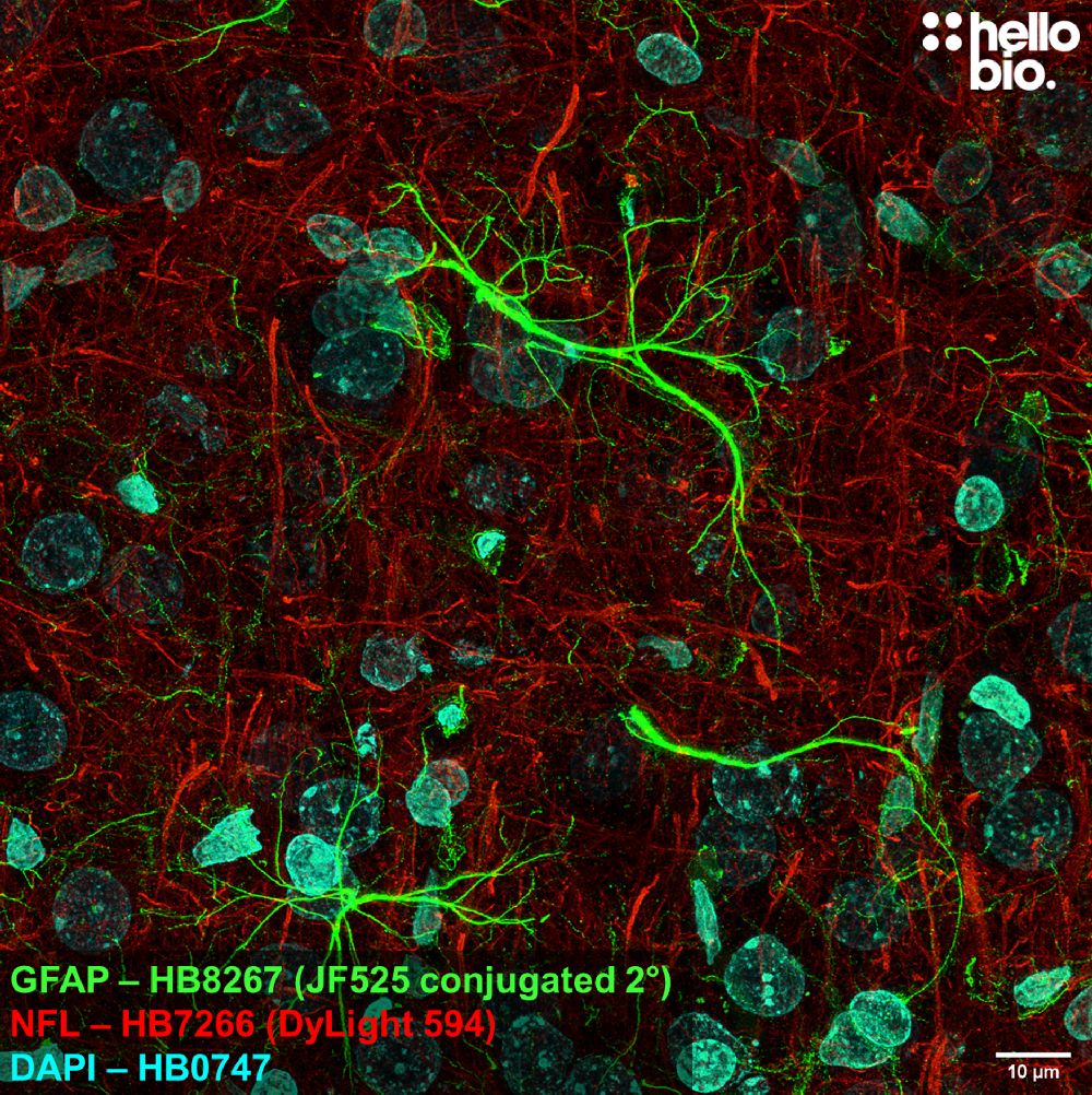 Fig 3. GFAP expression in rat brain visualised using a Janelia Fluor® 525 conjugated secondary antibody. 