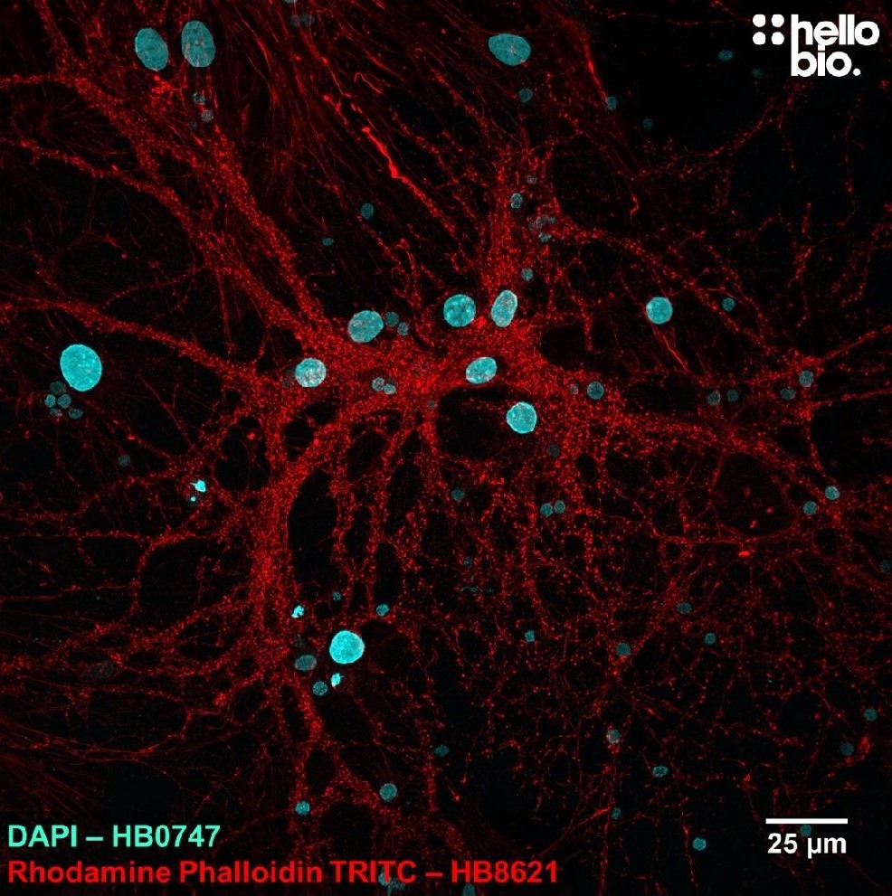 Figure. 1: Rhodamine Phalloidin TRITC and DAPI co-staining in neuronal cell culture. 