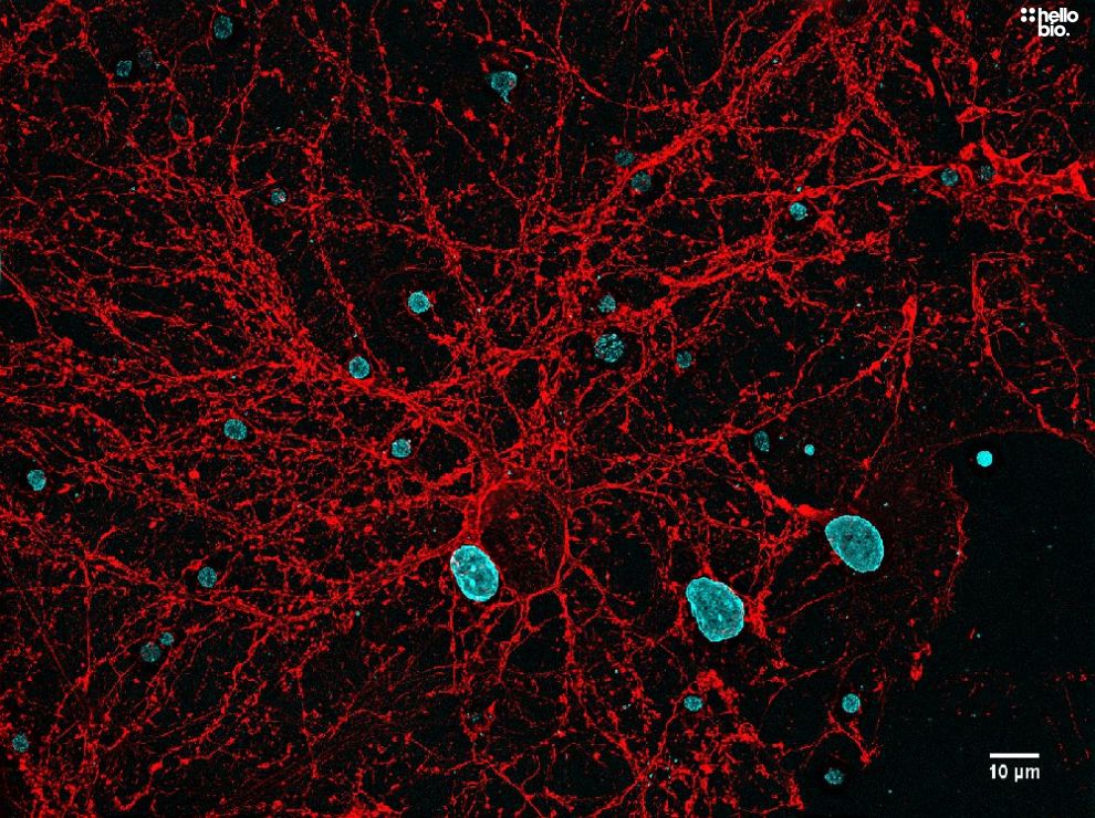 Figure. 2: Rhodamine Phalloidin TRITC and DAPI co-staining in neuronal cell culture.