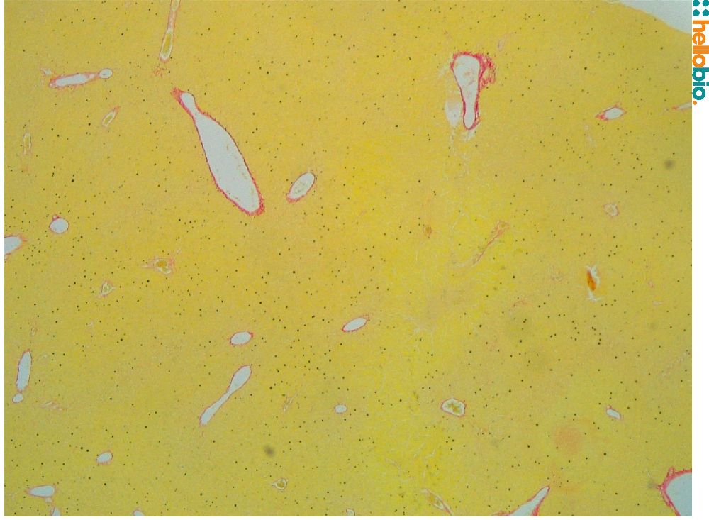 Figure. 9: Picro Sirius red staining in kidney tissue. 