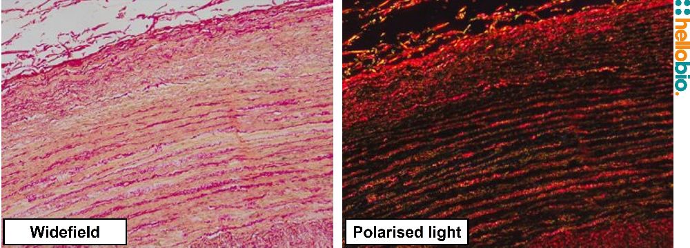 Figure. 10: Picro Sirius red staining in formalin fixed Chimpanzee aorta under both standard widefield illumination and polarised light. 