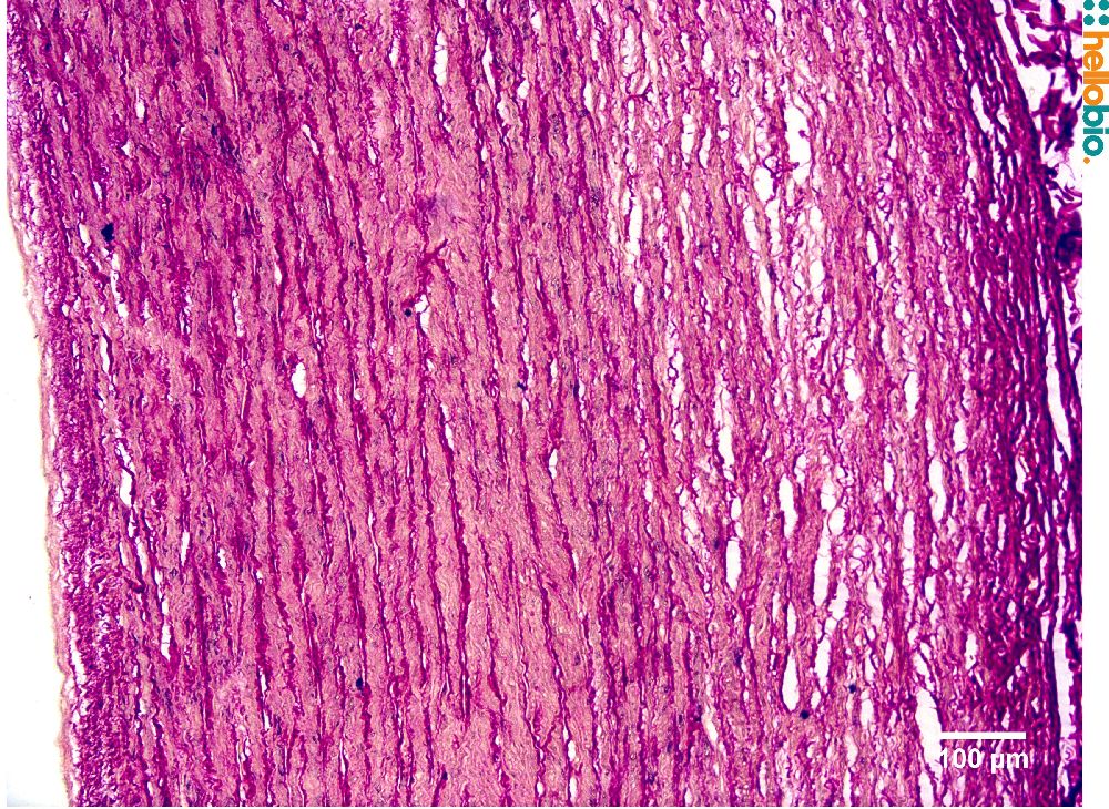 Picro Sirius red from Hello Bio stains collagen fibres red while muscle fibres are stained yellow. For protocol see notes below.