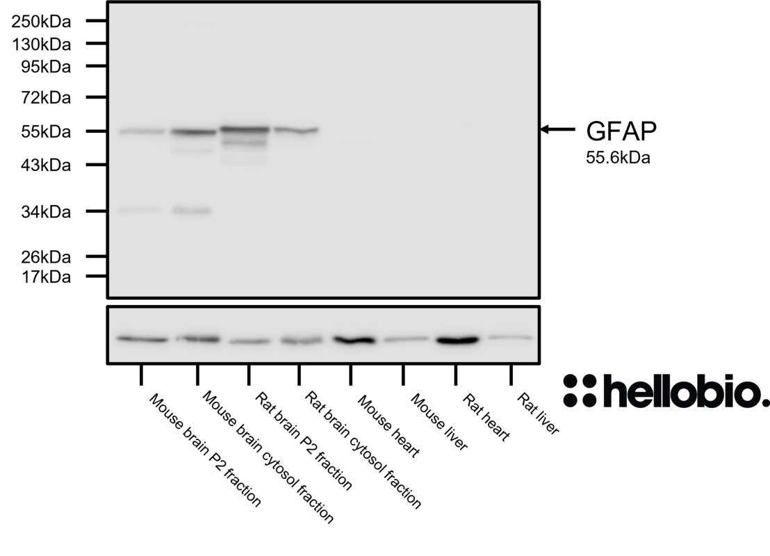 Figure 5. GFAP expression in various tissue lysates and preparations.
