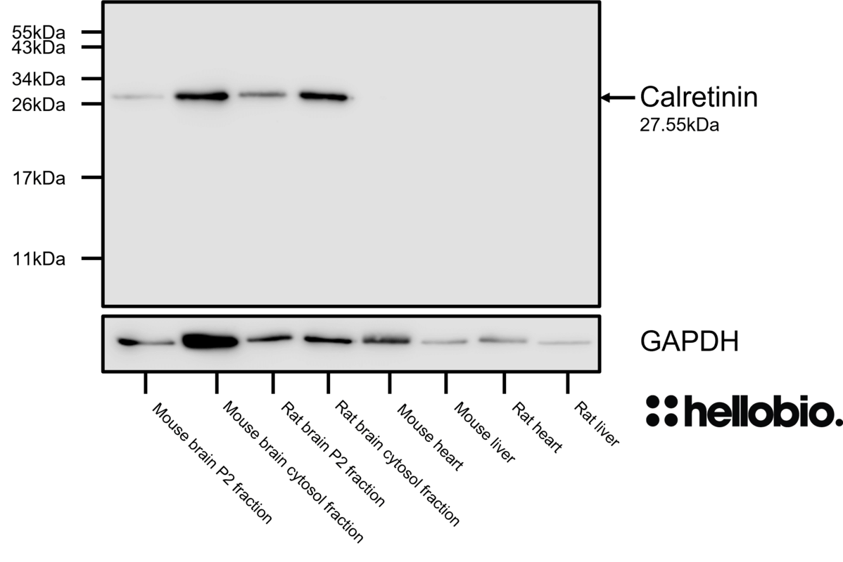 Figure 7. Calretinin expression in various tissue lysates and preparations.