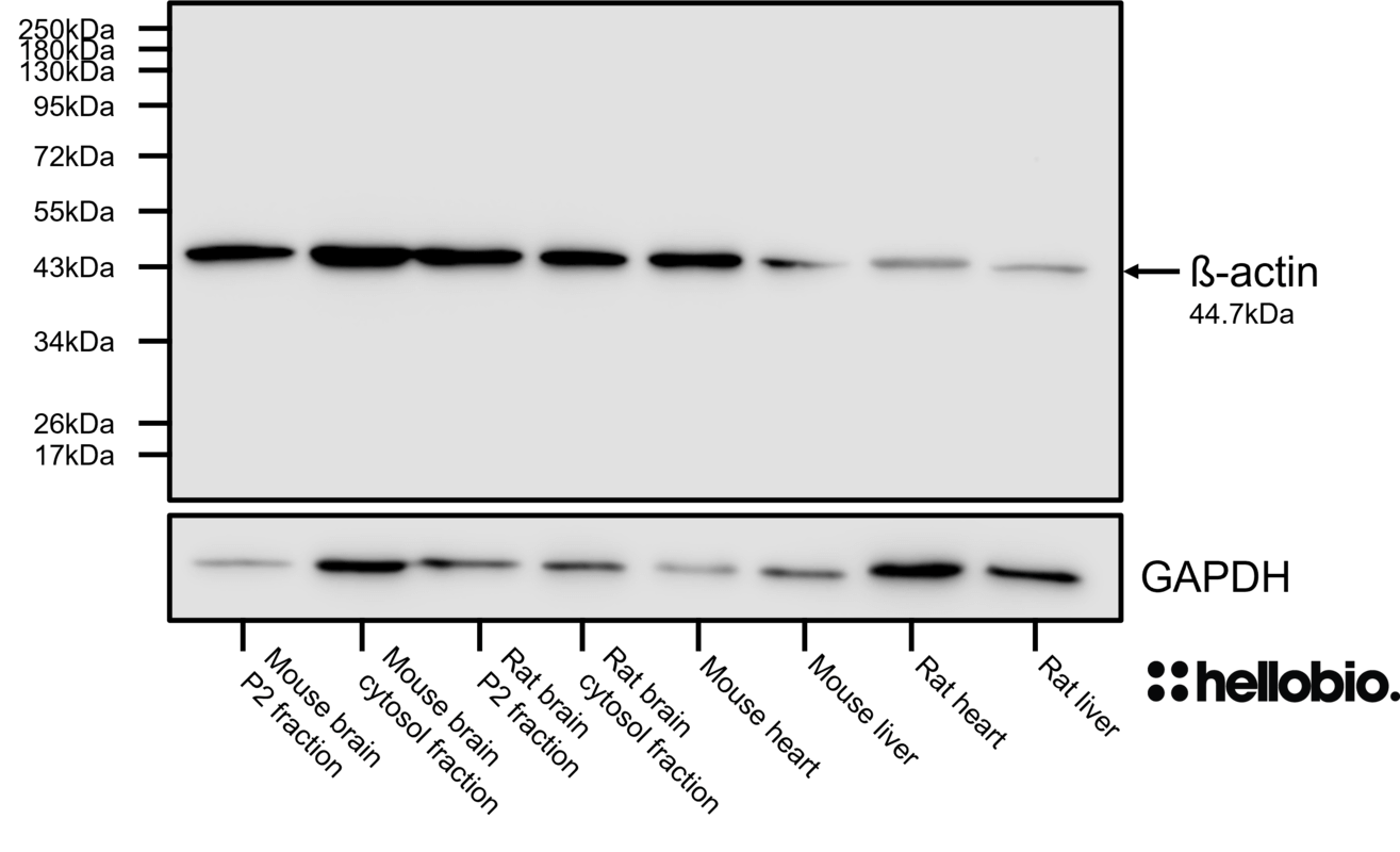 Figure 1. ß-actin expression in various tissue lysates and preparations visualised using HB8224